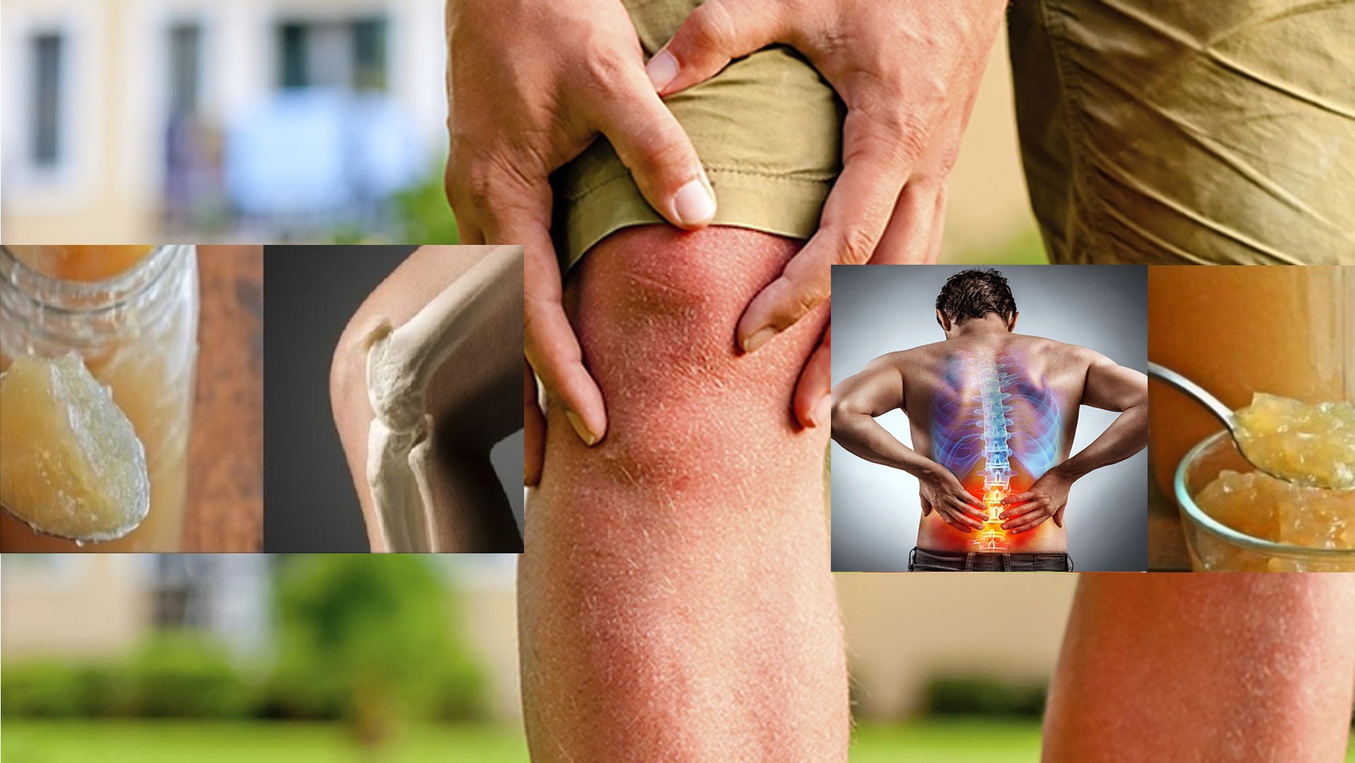 Genunchii îmi fac rău când alerg sau sar, durere laterala genunchi