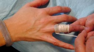 Ți-a rămas blocat pe deget inelul ori verigheta? Această metodă funcționează 100 %