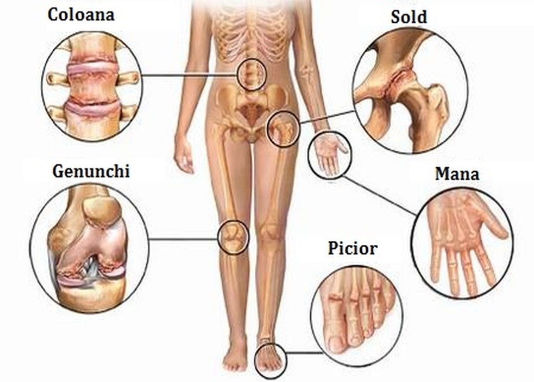 Remedii pentru dureri articulare. Știați că există remedii naturale care pot ușura acest tip de durere?