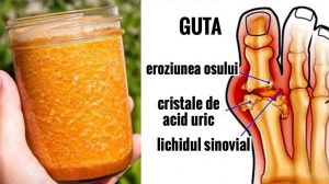 Spuneti adio gutei cu acest tratament natural!!!