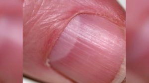 Ai așa ceva la baza unghiei, pe degete, se numește lunula și arată un indiciu prețios despre sănătatea ta, uite ce înseamnă dacă și a ta arată așa