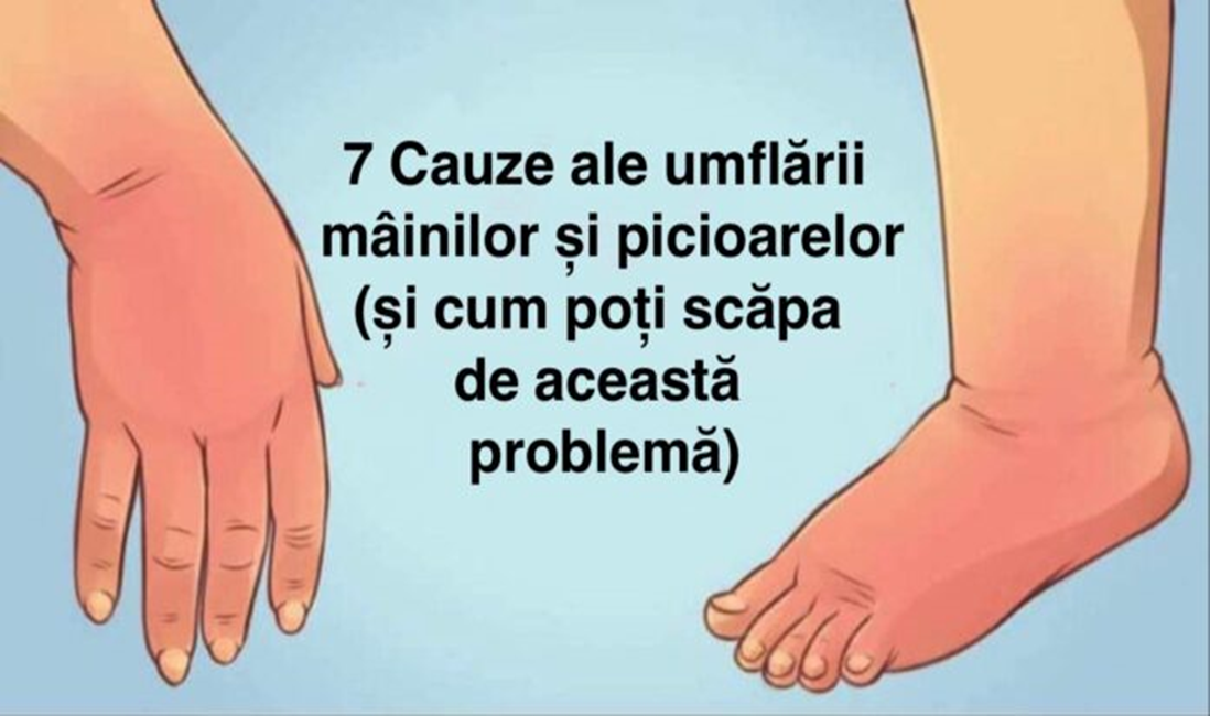 7 Cauze ale umflării mâinilor și picioarelor (și ce poți face pentru a scăpa de această problemă)