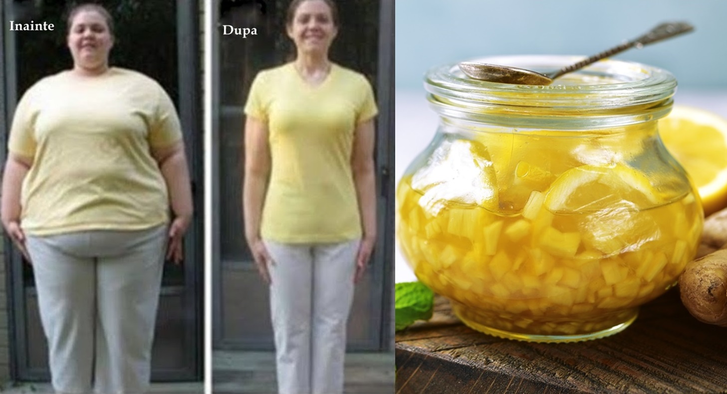 DIETA cu LĂMÂIE și GHIMBIR nu este restrictivă și te ajută să scapi de kilogramele nedorite în mod sănătos DIETA cu LĂMÂIE și GHIMBIR nu este restrictivă și te ajută să scapi de kilogramele nedorite în mod sănătos