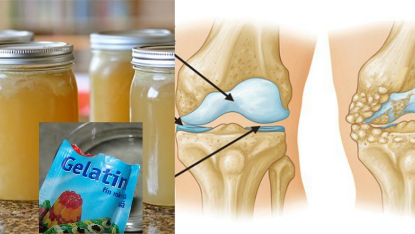 Gelatina alimentara – Cura de 7 zile pentru reumatism si dureri articulare, dureri de spate si de picioare