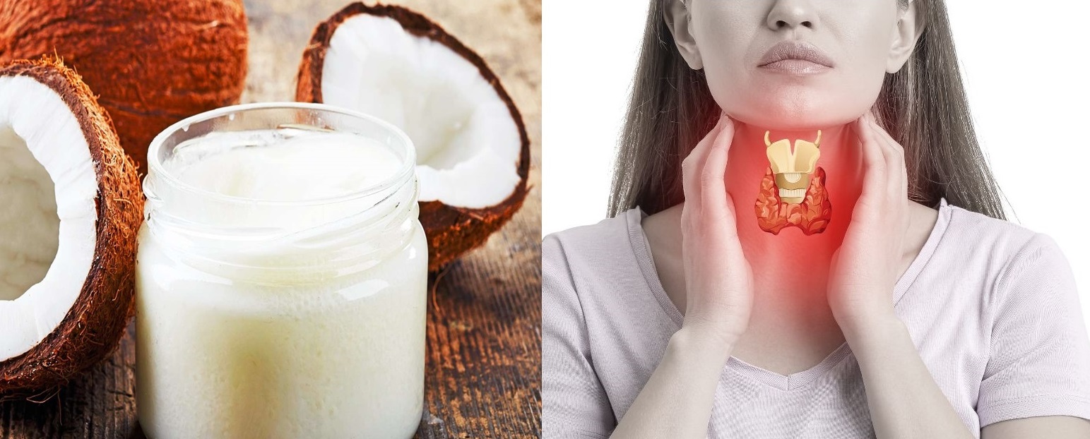 Știați că uleiul de cocos vă poate ajuta să vă tratați tiroida? Iată ce trebuie să știi!