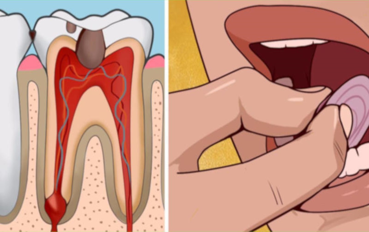 Vezi 9 remedii la domiciliu pentru durerile de dinți