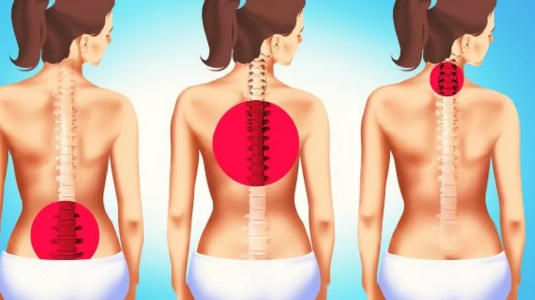 Cum să ameliorați durerile de spate fără exerciții fizice: Folosiți aceste 6 poziții