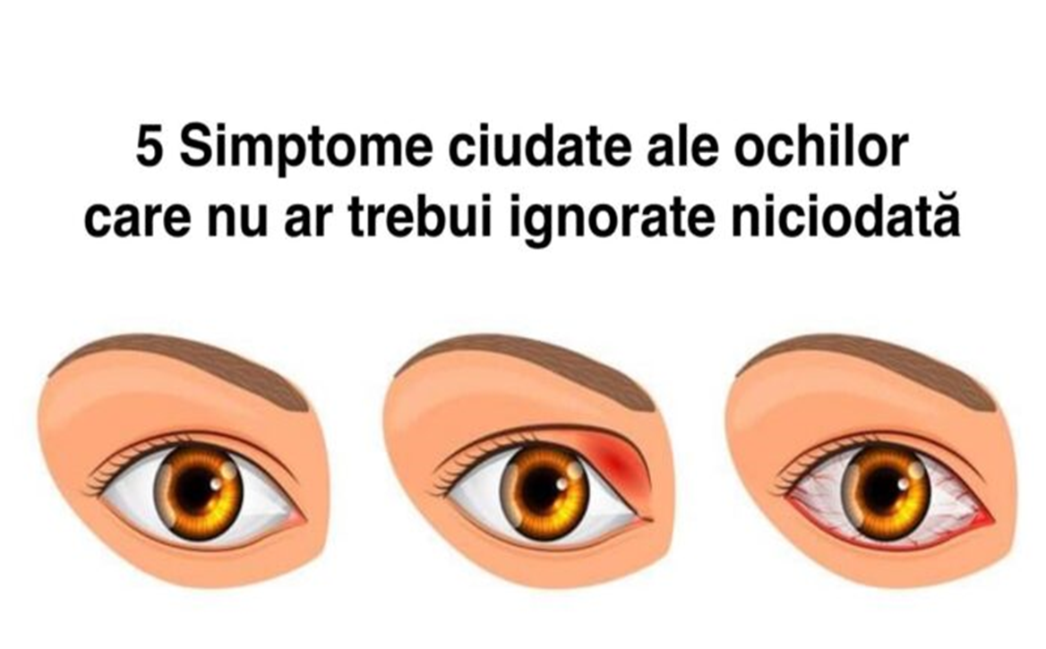 5 simptome ciudate ale ochilor. Nu le ignora niciodată deoarece ele pot semnala existența unei probleme grave