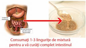 Mixtură din 2 ingrediente pentru curățarea colonului – elimină kilograme întregi de murdărie din sistemul digestiv