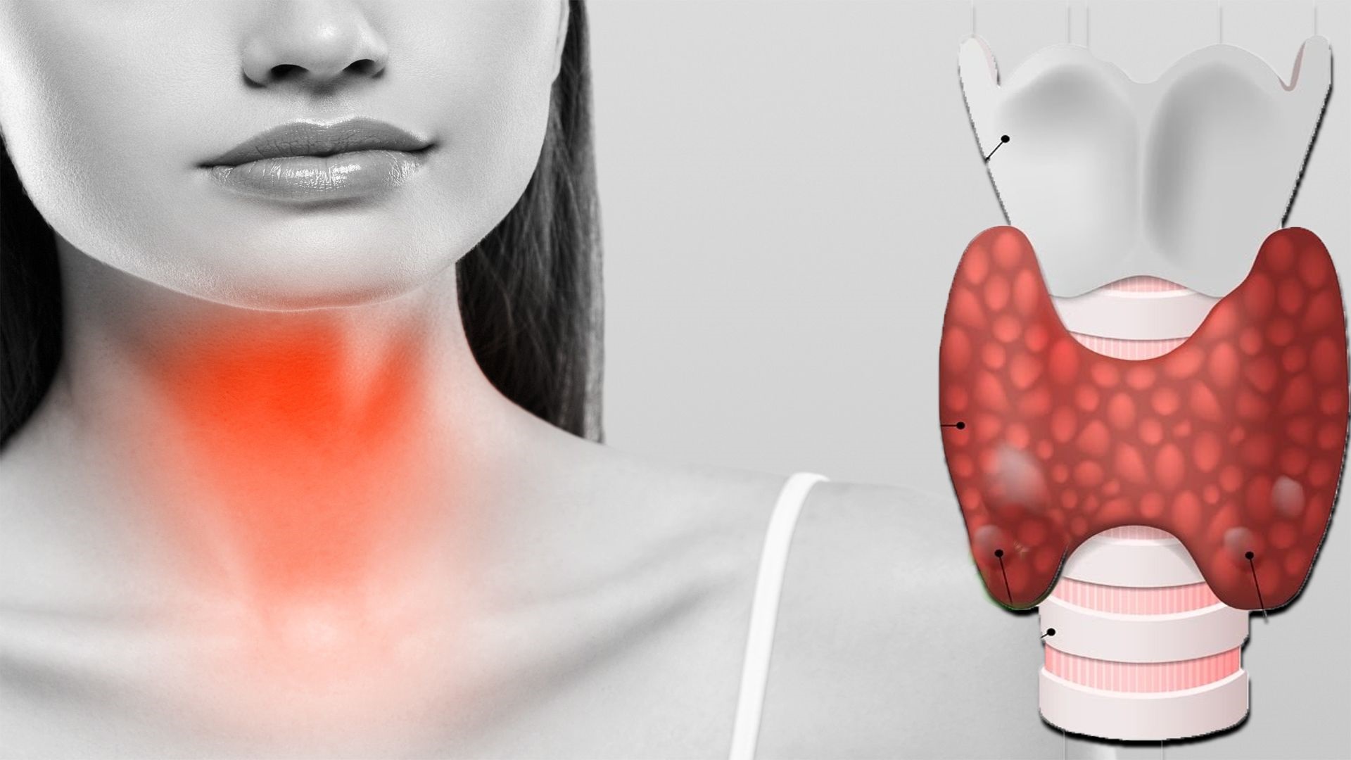 Probleme tiroidiene: 3 tratamente pe care le puteți aplica acasă … 5 obiceiuri care înrăutățesc problemele tiroidiene