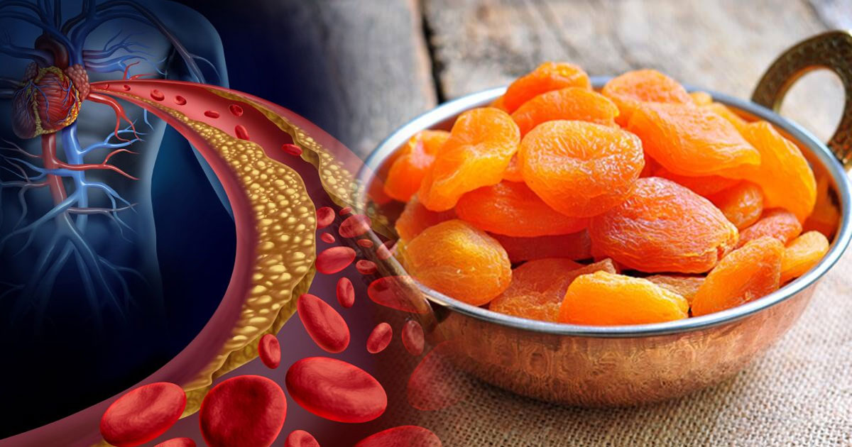 Caisele uscate curăță vasele de sânge, iar stafidele calmează nervii – iată 6 fructe uscate în loc de pastile